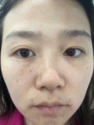 -素美医疗美容·西南眼鼻整形·修复基地