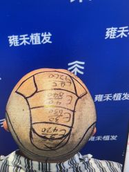 -雍禾植发全国连锁