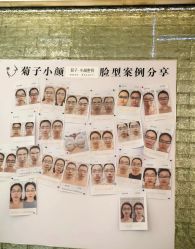 -菊子小颜·日式整骨·产后管理