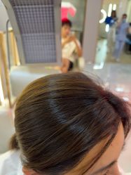 -碧莲盛不剃发植发