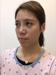 -广东韩妃整形外科医院