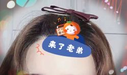 -大麦微针植发全国连锁