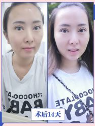 -广东韩妃整形外科医院