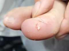 -新甲连锁灰指甲·甲沟炎·鸡眼(黑龙江路店)