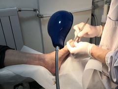 -世龙世家灰指甲鸡眼脚气甲沟炎跖疣护理(通州店)