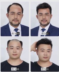 -发饰美男士增发补发假发定制店
