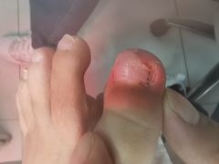 -新甲连锁灰指甲·甲沟炎·鸡眼(黑龙江路店)