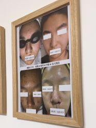 -美肤盾祛痘·问题肌头疗管理中心