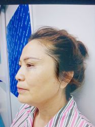 -郡艺医疗美容·微整·眼鼻吸脂