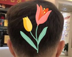 点击看大图 -大麦微针植发全国连锁