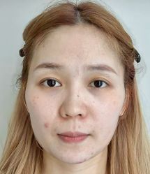 -Yestar艺星医疗美容医院
