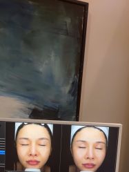 -苑苑vbeauty科技美容SPA