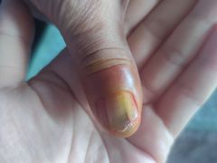 -复旦大学附属华山医院(总院)