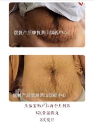 -丽复产后康复萧山旗舰中心