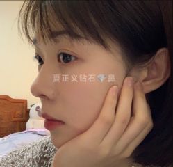-北京米扬丽格医疗美容·联合丽格鼻整形中心