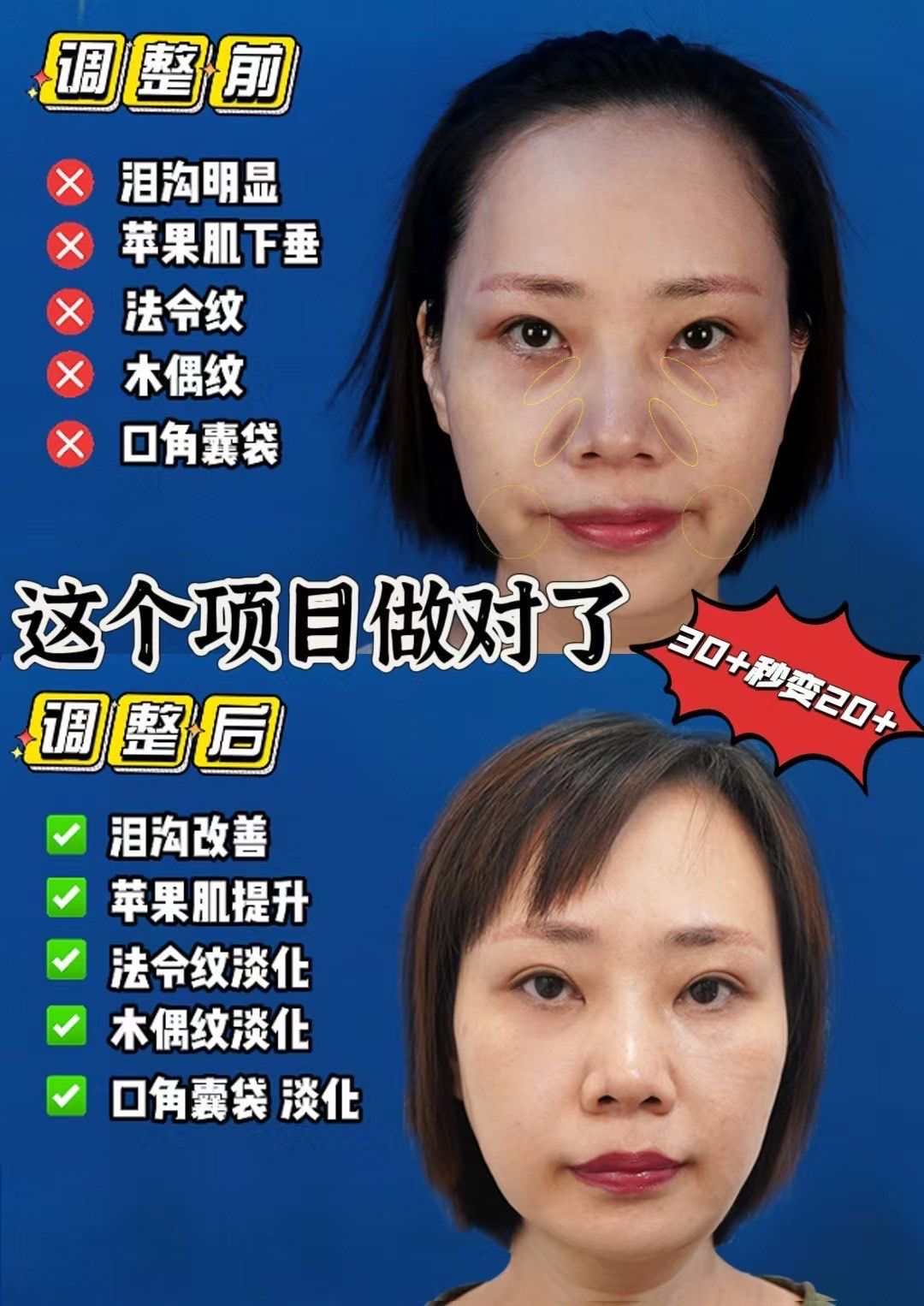 帮大家看脸的时候发现很多姐妹都会比较在意面部平整度的问题02
