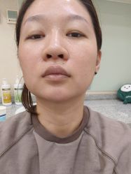 体验后-北京米扬丽格医疗美容·联合丽格鼻整形中心