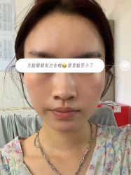 -肌密·水光·祛痘·黄金微针