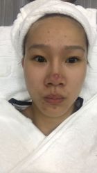 -痘博士天津·全国连锁祛痘机构