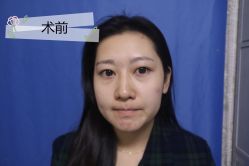 点击看大图 -广州健丽·去眼袋医疗美容机构