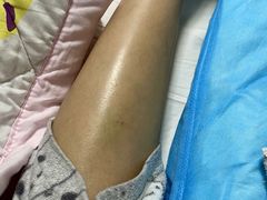 -成都市第一人民医院(南区)