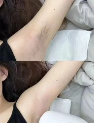 -美愈美肤MEIYU SKIN