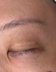 -深圳芙必优医疗美容·抗衰中心