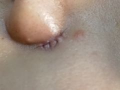 -北京大学第一医院(西城厂桥院区)