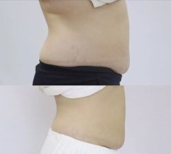 -MOE BEAUTY.皮肤管理中心
