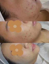 -VE专注问题肌·赛诺龙&科学美肤中心