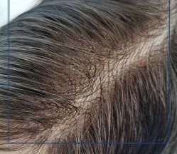 -发饰美男士增发补发假发定制店