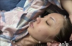 -北京米扬丽格医疗美容·联合丽格鼻整形中心