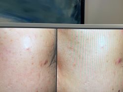 -苑苑vbeauty科技美容SPA