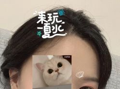 -大麦微针植发全国连锁