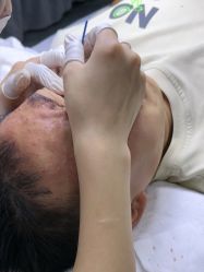 -苗方清颜专业祛痘·皮肤管理