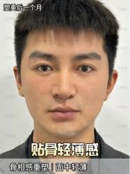 -美莱医学美容医院