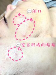 -Doria salon 小颜皮肤