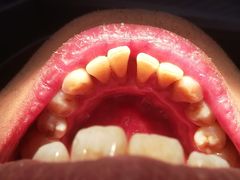 -泰康拜博口腔(世博园乐尔店)