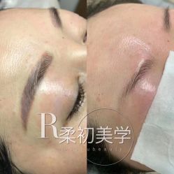 -RC半永久纹眉纹发际线