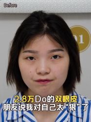 点击看大图 -重庆军科整形美容医院