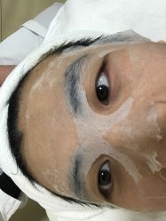 -蕾特恩专业祛痘国际连锁