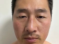 -东南大学附属中大医院(本部)