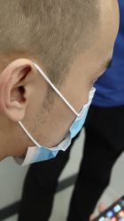 -大麦微针植发全国连锁