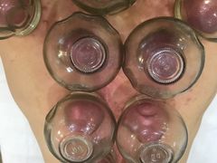 -传古推拿·古法按摩(义井路店)