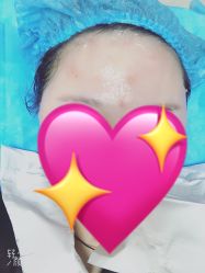 点击看大图 体验后-紫洁俪方(北京)医疗美容
