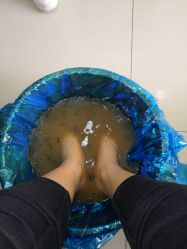 -德哥灰指甲脚气甲沟炎跖疣护理