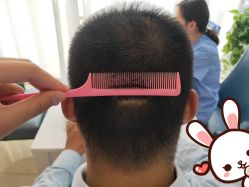 点击看大图 -大麦微针植发丨全国连锁