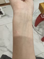-星荟丽格医疗美容·黄金微针·胶原美肤中心