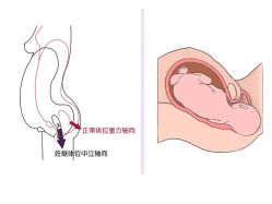 -百佳医疗级月子会所