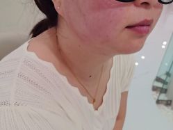 -Yestar艺星整形美容医院